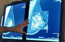 Mamografías para detectar tumores de mama / AP/TORIN HALSEY